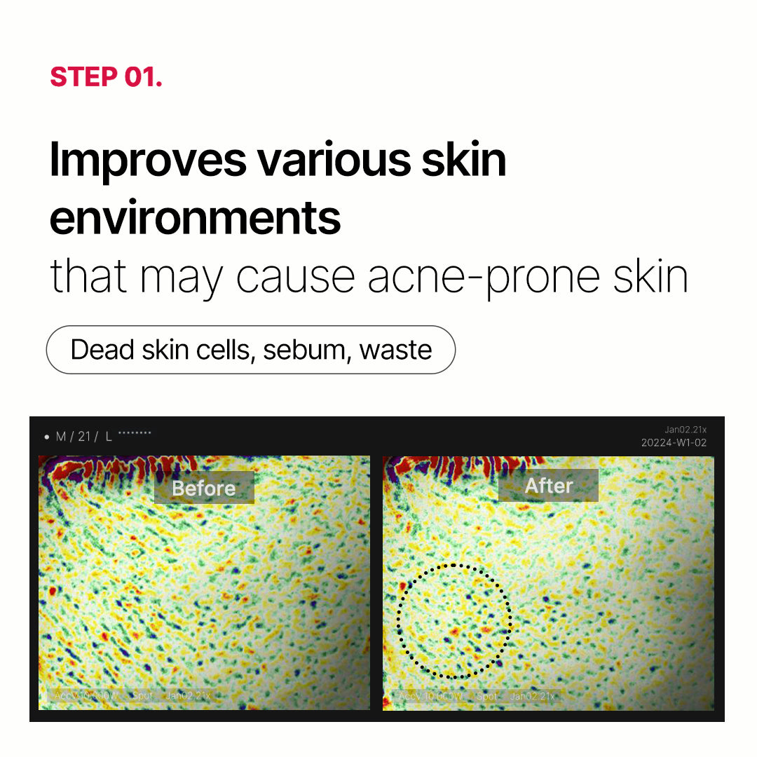 Red Succinic Acid Panthenol Pads