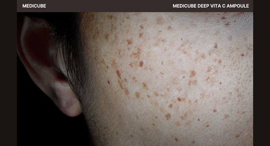 Deep Vita C Ampoule