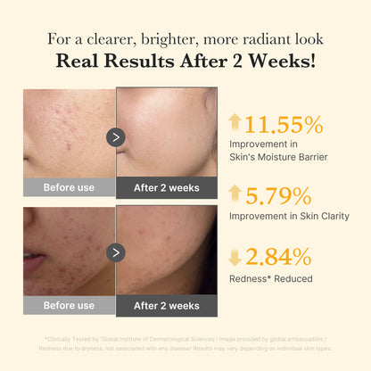 Kojic Acid Turmeric Capsule Serum