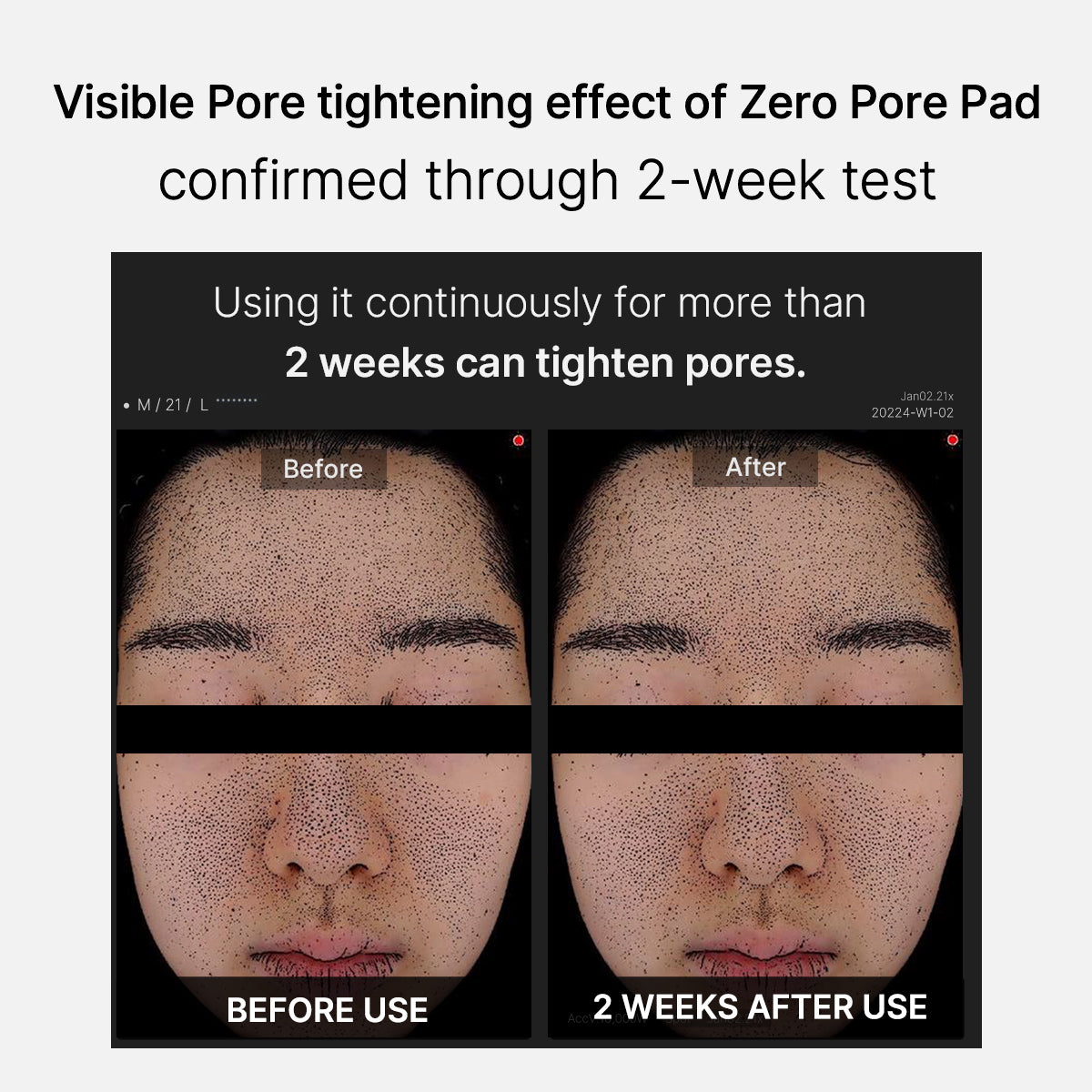 Zero Pore Pad REFILL SET