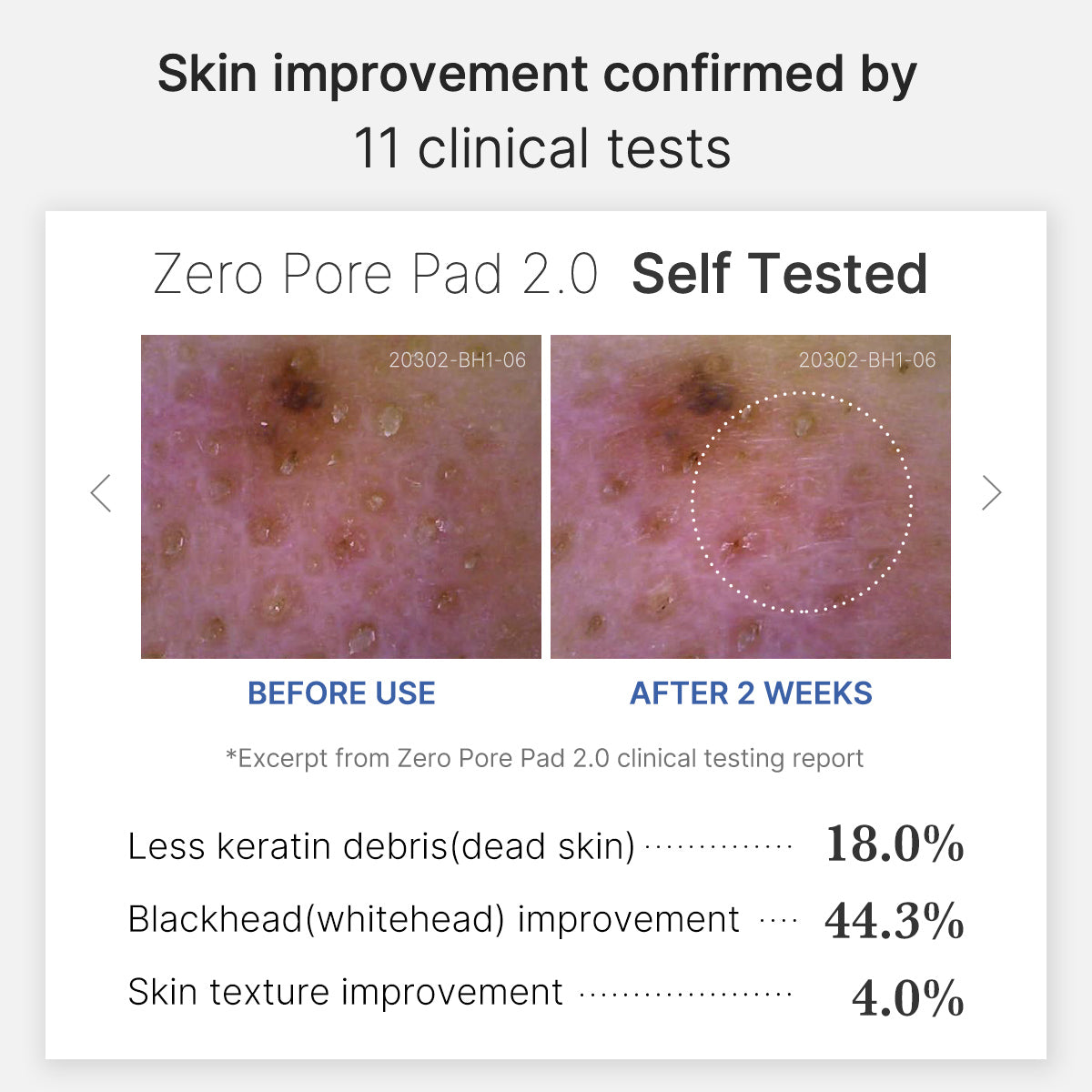 Zero Pore Pad 2.0 - EyeNez User Review