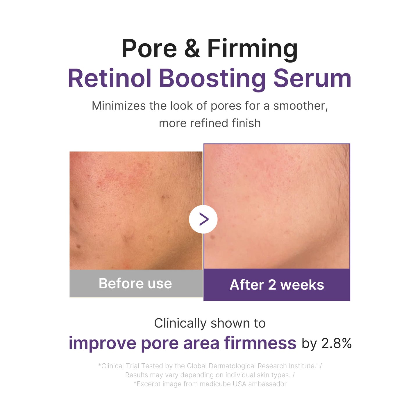 Retinol NMN Boosting Serum