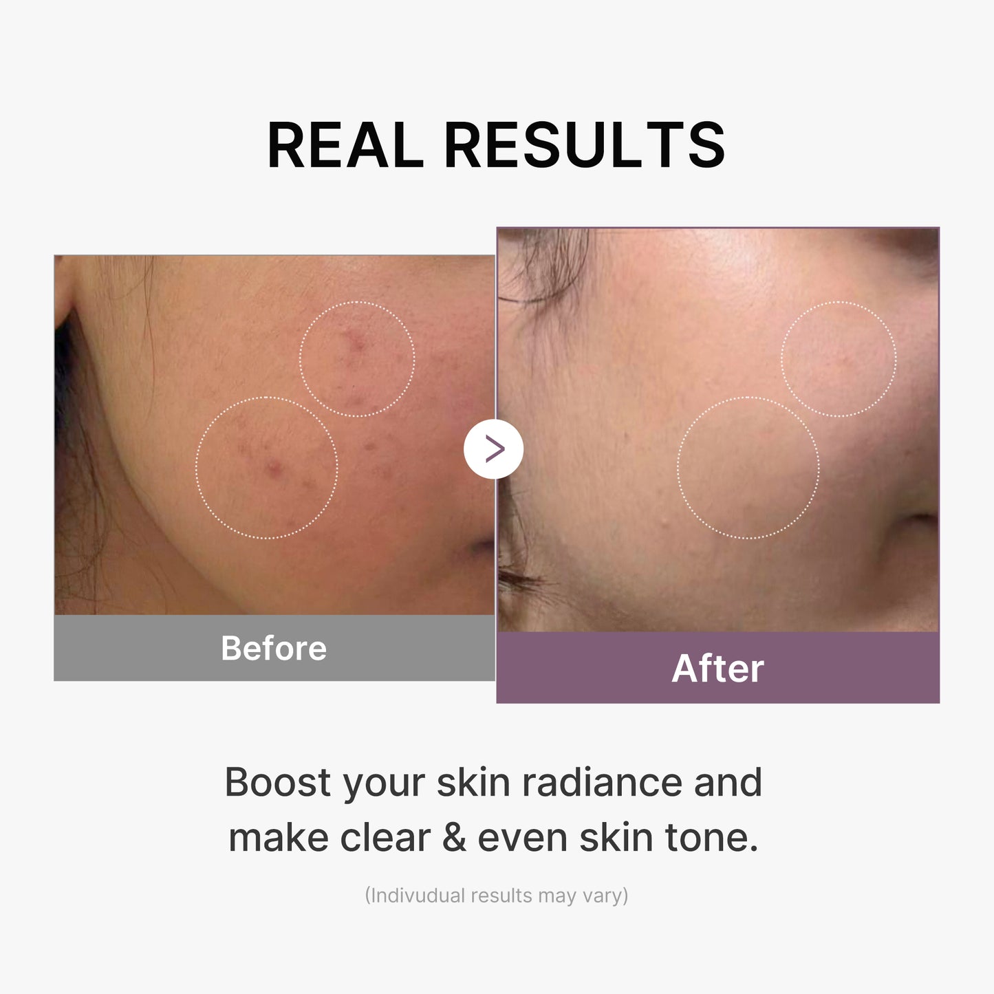 AGE-R Glutathione Glow Milk Toner