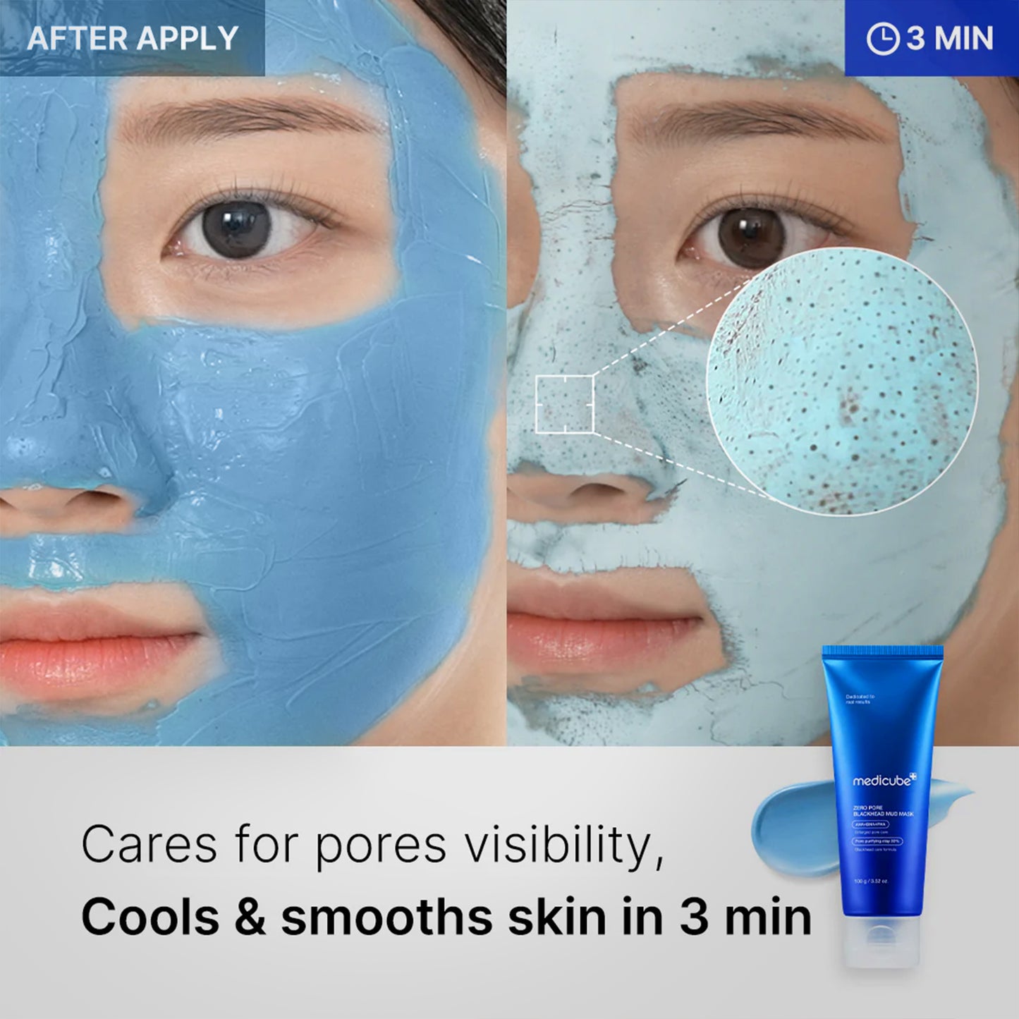 Zero Pore Blackhead Mud Mask