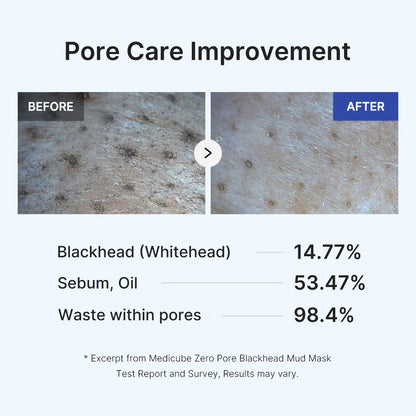 Zero Pore Blackhead Mud Mask