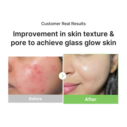 Exosome Cica Calming Toner Pads