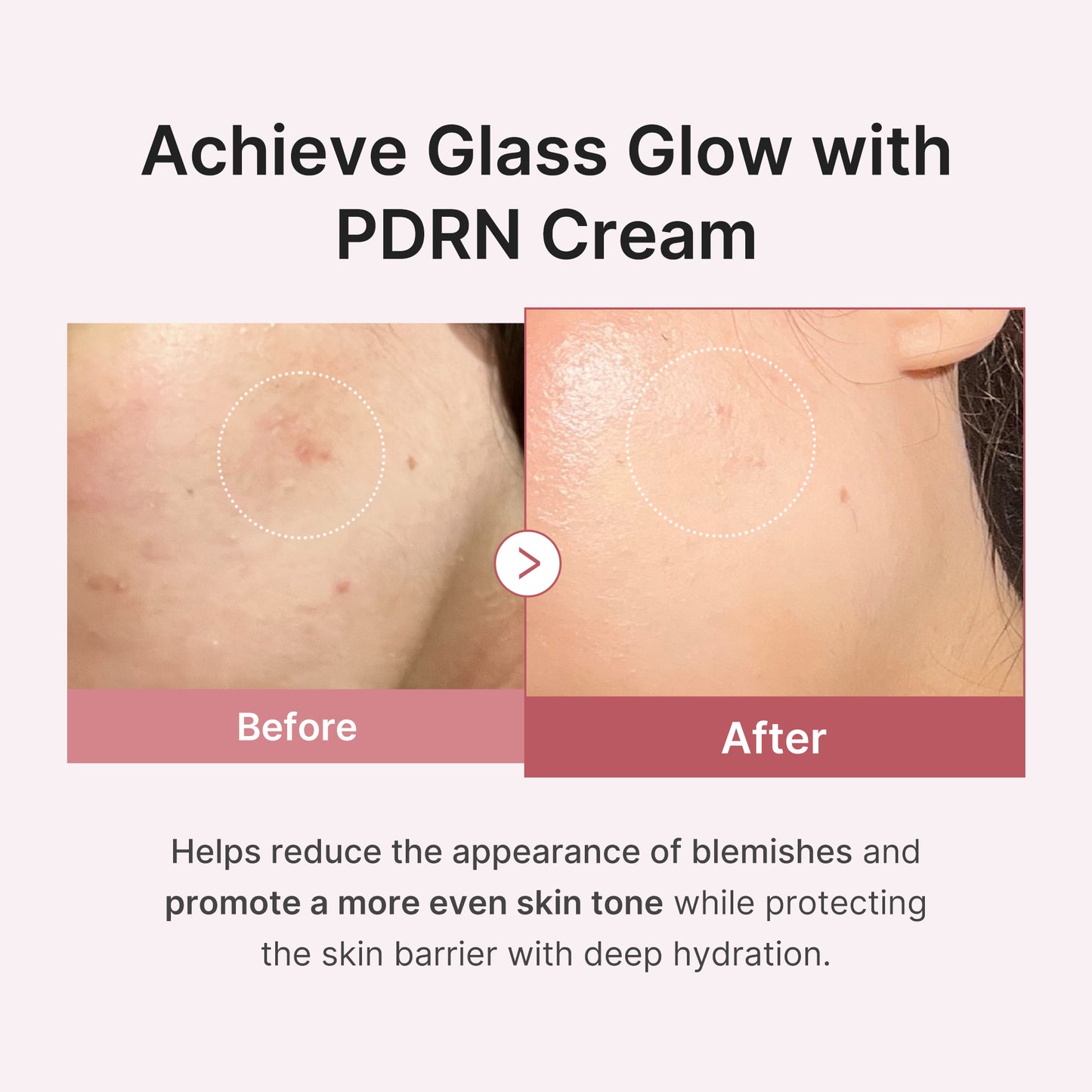 PDRN Pink Peptide Cream
