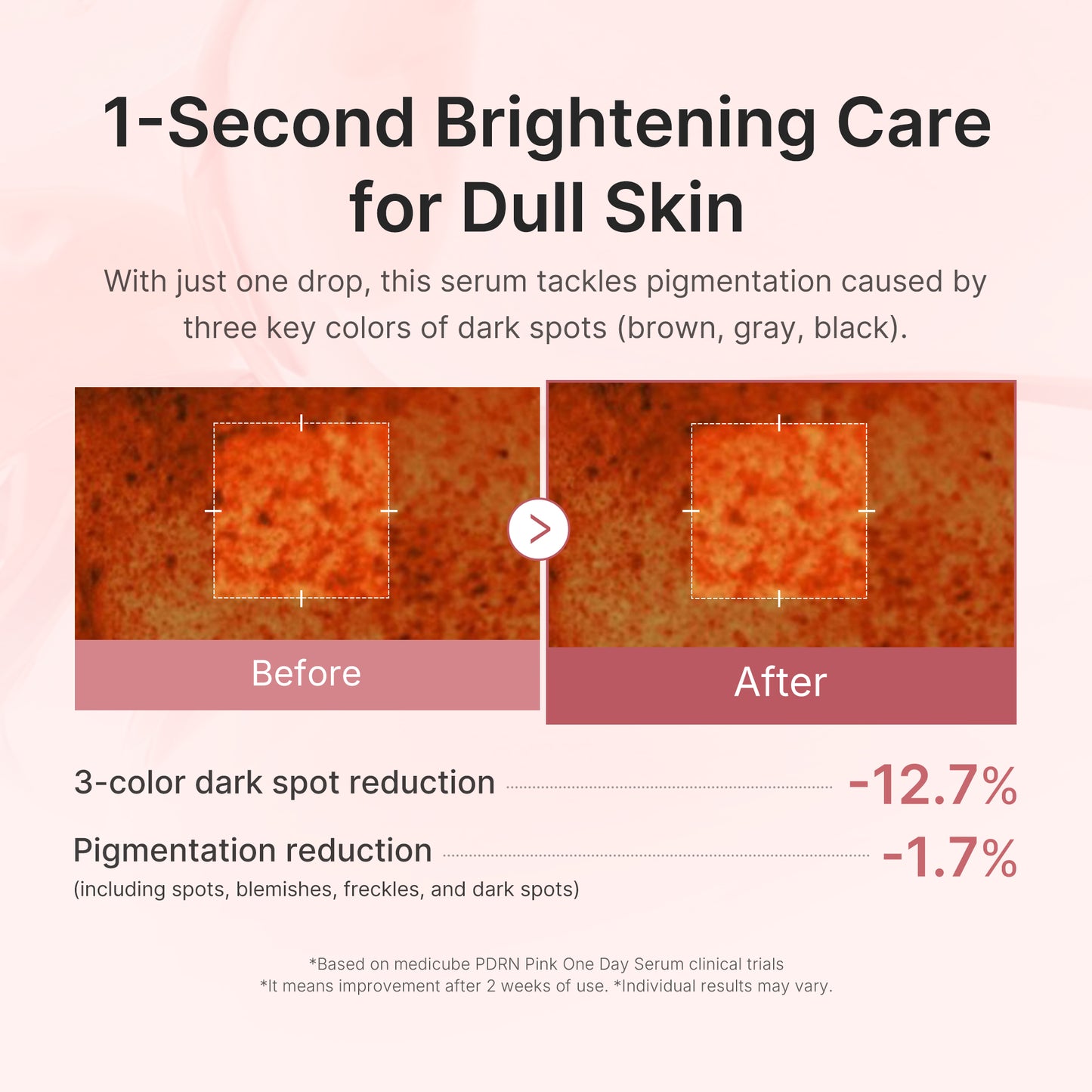 Salmon PDRN Pink One Day Serum